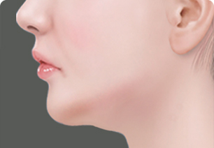 상담 모습