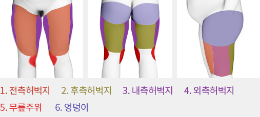 허쉬성형외과 코라인